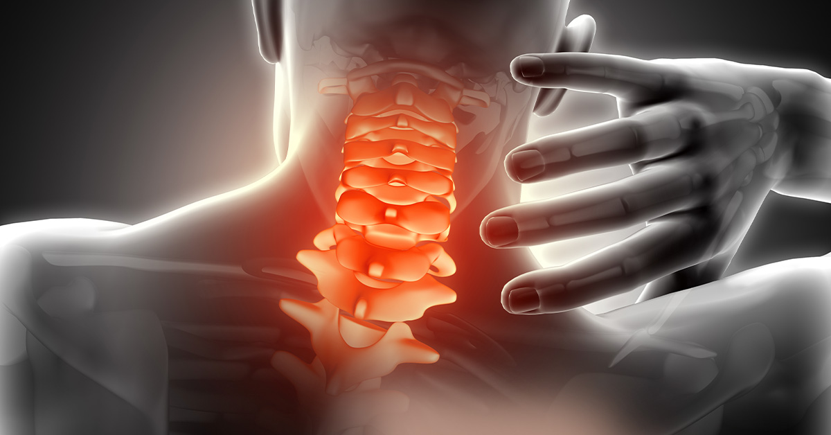 Kissun Chiropractic - Most Common Neck Pain Causes